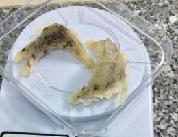 Khi nào nên dùng tổ yến để tẩm bổ?